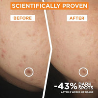 Garnier Skin Active, Face Serum, Brightening &amp; Anti-Dark Spots, 3.5% Vitamin C, 30 ml
